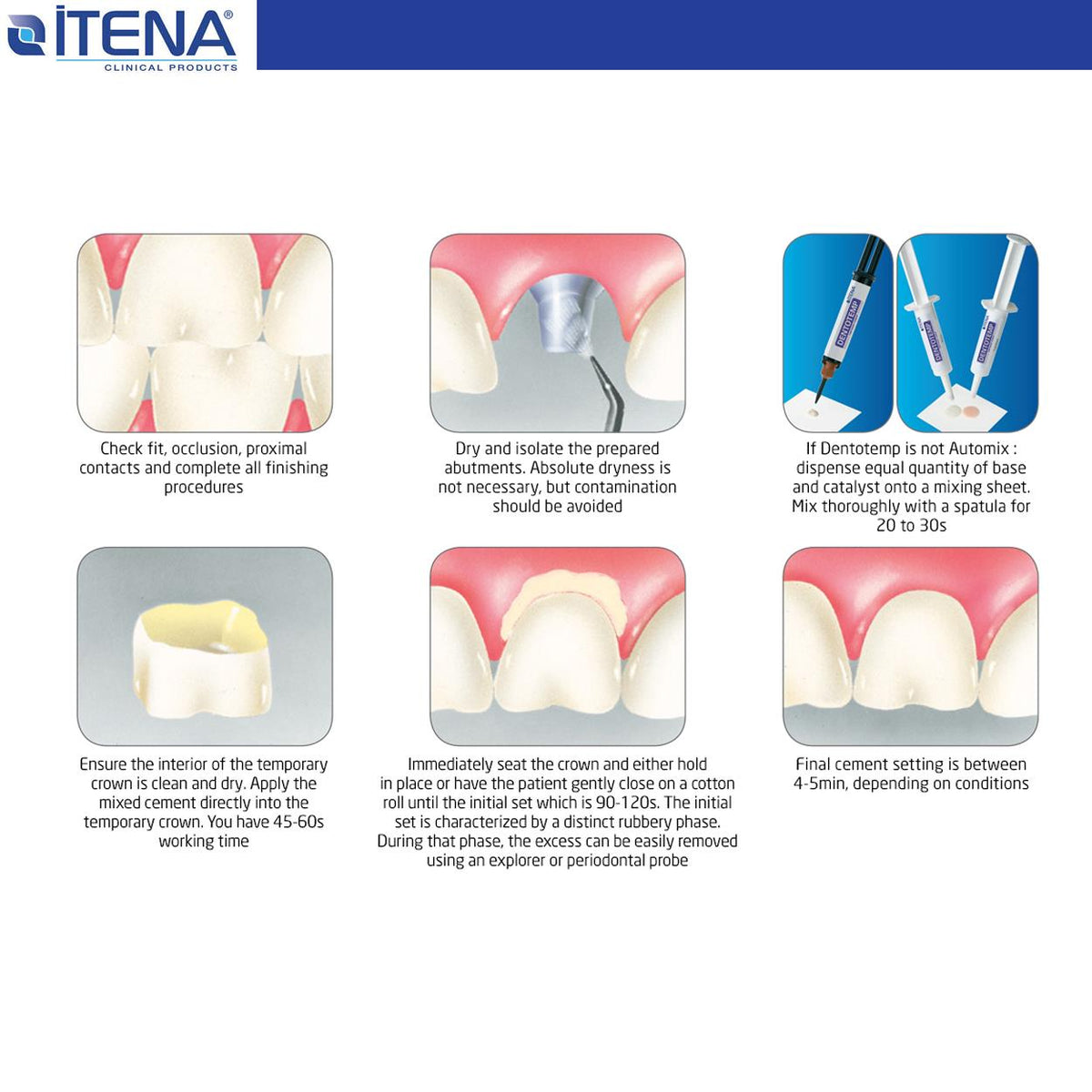 Itena - Dentotemp Automix Implant Cement 2x6 gr