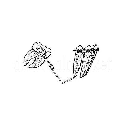 Dynaflex - Molar Uprighting Springs