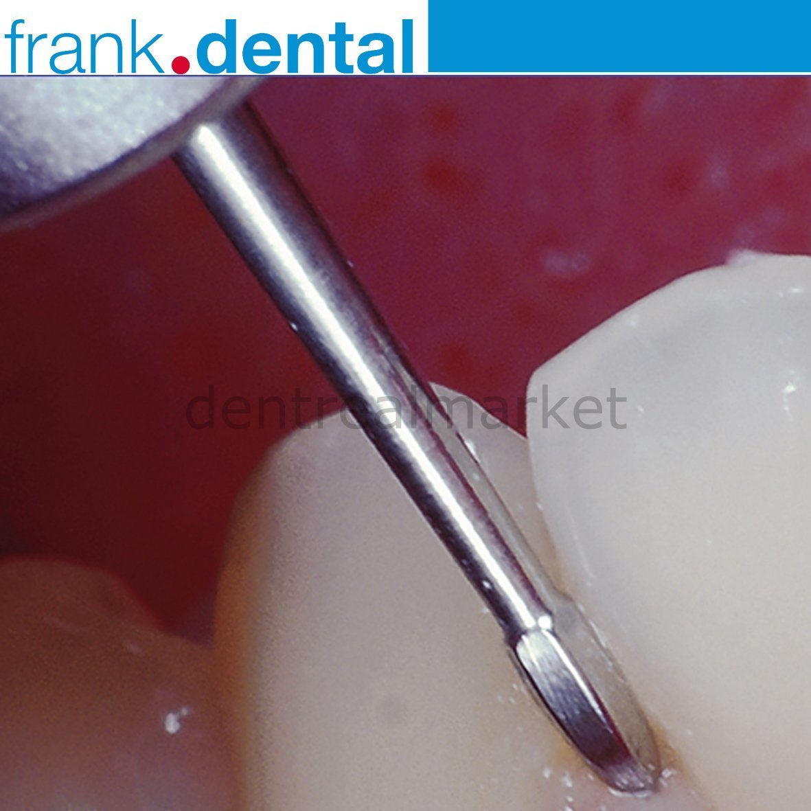 Frank Dental - Perio Bur 758