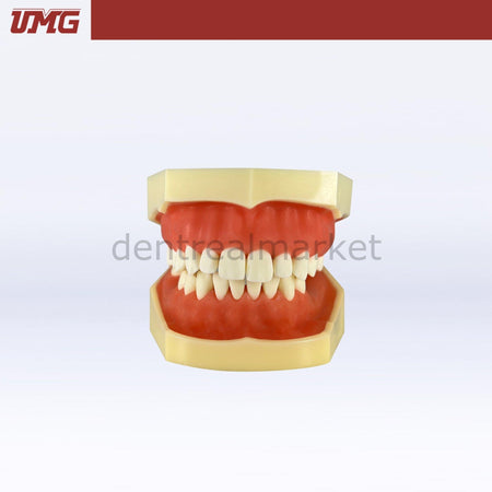 Umg Dental - Umg Model Implant Training Model Upper - Lower Jaw - UM - 2030