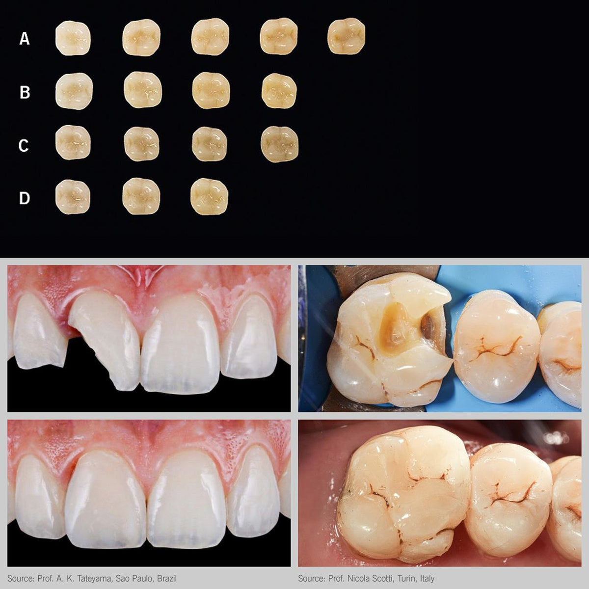 DentrealStore - Heraeus Kulzer Charisma Diamond One Chameleon Composite Kit