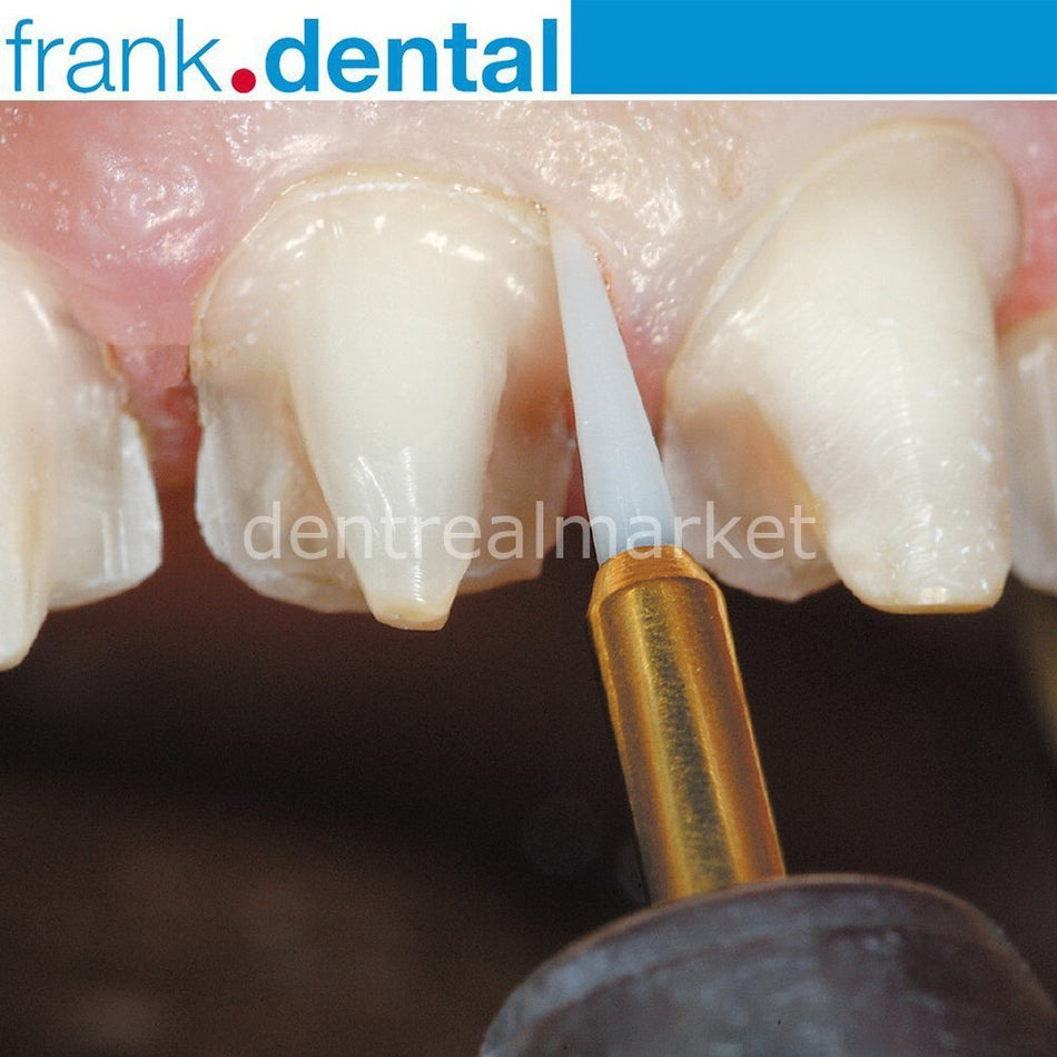 DentrealStore - Frank Dental Soft Tissue Gingiva Trimmer Burs - Ceramic Gingiva Bur - GT135-STT250